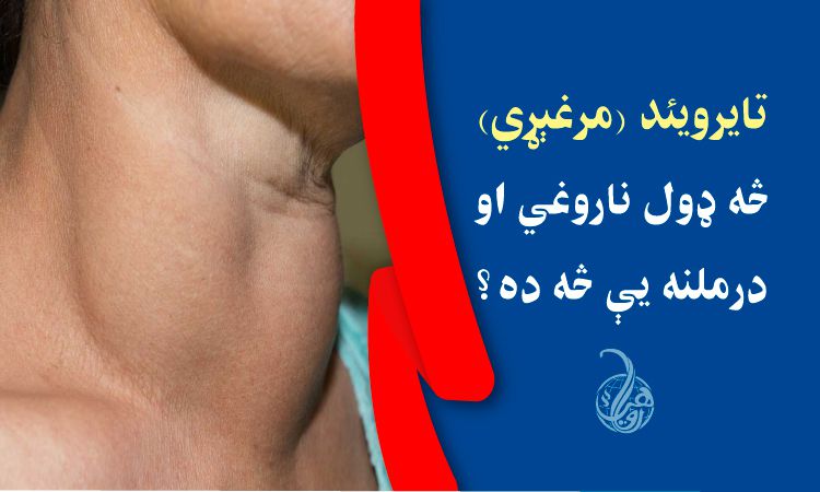 تايرويئد (مرغېړي) کله پرې اخته شوي ياست؟ څه ډول ناروغي او درملنه يې څه ده؟ 